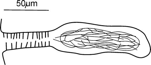 Figure 5 Cernosvitoviella longiducta n. sp. spermatheca.