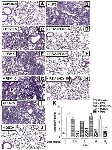 Figure 4 Effect of treatment with RSV or RSV-LNCs on lung pathological changes. A/J mice were orally pretreated with RSV, RSV-LNCs (2.5–10 mg/kg),ULNCs or Dexa (5 mg/kg) 4 h before challenge with LPS. Analyses were performed 24 h after LPS stimulation. (A-J) Representative images of LPS-induced pathological changes and (K) analysis of lung damage by semiquantitative score system.Notes: Data are expressed as the mean ± SEM (n=5–7). +++P<0.001 compared with the saline group and ***P<0.001 compared to the LPS group.Abbreviations: RSV, resveratrol; RSV-LNCs, resveratrol-loaded lipid-core nanocapsules; Dexa, dexamethasone; LPS, lipopolysaccharide.
