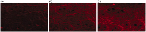 Figure 8. Laser scanning confocal micrograph of NE in different times. (a) 2 h in vitro treatment with NE; (b) 6 h in vitro treatment with NE; (c) 12 h in vitro treatment with NE.