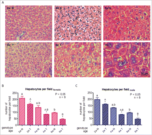 Figure 1. Histological analysis of livers from growing GH-overexpressing transgenic mice and normal littermates. A: Representative photomicrographs of hematoxylin and eosin staining of liver sections from normal and GH-transgenic male mice. B: Hepatocyte quantification in female mice. C: Hepatocyte quantification in male mice. Hepatocyte size of GH-transgenic animals (T) and their non-transgenic littermates (N) was assessed for 2-week-old (2w), 4-week-old (4w) and 9-week-old (9w) mice. Hepatocyte size was estimated counting the number of cells per visual field; original magnification of 400x. Data are the mean ± SEM of 8 sets of different individuals per group. Different letters denote significant difference by age within a genotype; small letters correspond to normal mice and capital letters to transgenic animals. Asterisks indicate significant difference between GH-overexpressing animals and their corresponding non-transgenic age controls.