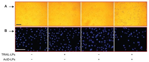 Figure 3 Induction of apoptosis in A-549 cells by TRAIL liposomes and/or ActD liposomes. (A) Bar = 250 μm. (B) Bar = 250 μm.Abbreviations: TRAIL, tumor necrosis factor-related apoptosis-inducing ligand; ActD, actinomycin D; LPs, liposomes.