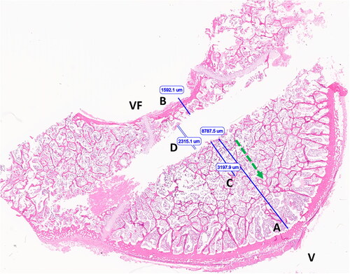 Figure 3. Image of vertebral body following ex vivo microwave ablation (H&E stained section). Optimal T1 placement distance (A); optimal T2 placement distance (B); extent of nuclear streaming/precipitation (necrosis) (C); applicator tract width (D). Ventral surface (V), vertebral foramen/dorsal aspect (VF), ablation direction (green arrow).