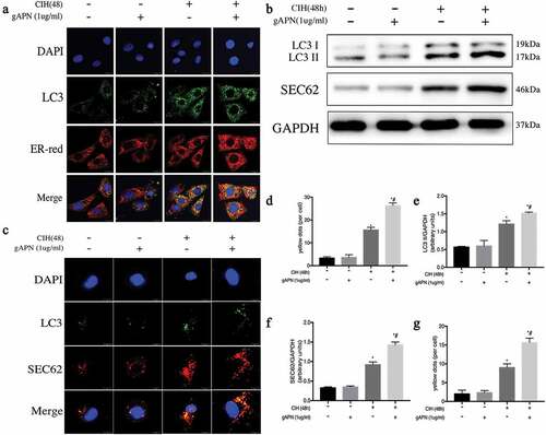 Figure 3. ER-phagy and SEC62 activation in H9C2 cardiomyocytes exposed to CIH (48 h) or with gAPN (1 µg/ml). (a, d) Fluorescence staining of LC3 (green) co-localized with the ER probe (red). Nuclei were stained with DAPI (blue). The scale bars represent 20 μm. (b, e–f) Protein expression levels of LC3II and SEC62. (c, g) Fluorescence staining of LC3 (green) co-localized with SEC62 (red). Nuclei were stained with DAPI (blue). The scale bars represent 10 μm. Data represent mean ± SD. n = 3. *P< 0.05, vs NC group. #P< 0.05, vs CIH group