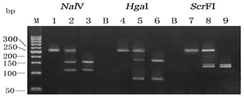 Figure 1 Detection of human β-defensin-1 gene variations in the 5ʹ-UTR (G-52A, C-44G, and G-20A) by restriction enzyme digestion with NalV, HgaI, ScrFI, respectively, followed by 3% agarose gel electrophoresis. Lanes 1 AA genotype, lanes 2 GA genotype, lanes 3 GG genotype of SNP G-52A; lanes 4 CC genotype, lanes 5 CG genotype, lanes 6 GG genotype of SNP C-44G; and lanes 7 AA genotype, lanes 8 GA genotype, lanes 9 GG genotype of SNP G-20A. B is the blank comparison.