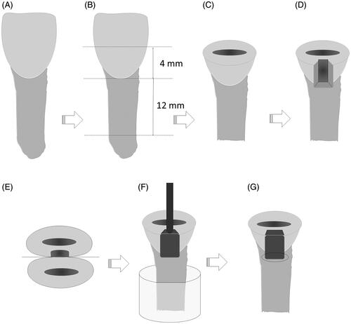Figure 1. Experimental design. (A) Bovine incisor; (B) sectioning the tooth crown on flat surface 4.0 mm above the CEJ and the root 12.0 mm below the CEJ. (C) Final dimensions of the tooth; (D) class II slot preparation in the proximal and occlusal-gingival directions; (E) positioning with the adjacent tooth and metal matrix for restoration placement; (F) loading device on top of the restoration; (G) marginal gap measurement area.