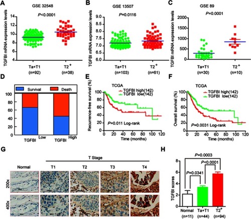 Figure 1 Upregulation of TGFBI was correlated with poor survival prognosis and invasive progresses of BCa. (A–C) TGFBI mRNA expression levels were increased in MIBC tissues (≥T2) compared with NMIBC tissues (Ta or T1) obtained from the three publicly accessible BCa datasets (GSE32548, GSE13507, and GSE89). (D–F) From TCGA urothelial cancer specimen cohorts, compared with the patients with low expression level of TGFBI (the lower 35%), the patients with high mRNA expression (the upper 35%) of TGFBI had higher death rates, shorter DFS, and OS. (G) Immunohistochemistry analysis of the expression of TGFBI protein in normal tissues and BCa tissues at different tumor stages. (H) Differences in expression levels of TGFBI protein in normal, NMIBC (Ta or T1), and MIBC tissues (≥T2).