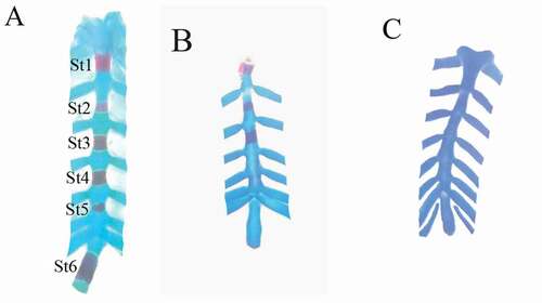 Figure 5. Photographs of the sternum of fetuses at 20th day of gestation (Alcian blue–Alizarin red double stain). (A) Control group: ossification of all sternebrae. (B) LD group: incomplete ossification of the sternum. (C) HD group: unossified sternebrae