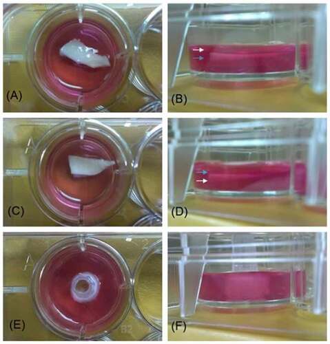 Figure 3. Images of decellularized scaffold in agarose gel. images A, C, and E are vertical projections. images B, D, and F are horizontal projections. In A) and B), the intima surface was facing upward (white arrow: intima; blue arrow: adventitia), whereas in C) and D), the adventitia surface was facing upward. In E and F, the pulmonary artery was cut into a 0.5 cm inner diameter × 0.5 cm long segment and a plastic microtip was insert in the vascular cannel to allow the cross section of the vessel facing upward at the center of a 12-well plate.