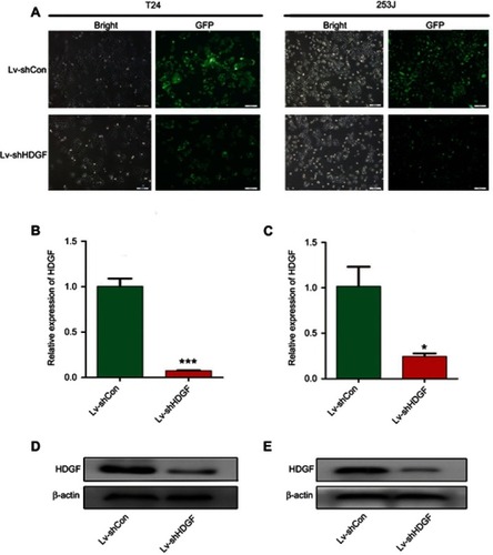 Figure 2 Lentivirus-mediated interference downregulates the expression of Hepatoma-derived growth factor (HDGF) in BCa cells. (A) The bladder cancer cells are examined by fluorescence microscopy after lentivirus infection for 72 h. (B–C) Real-time qPCR indicates mRNA levels are lower in T24 and 253J cells infected with Lv-shHDGF than Lv-shCon. (D–E) The protein levels of HDGF are downregulated in T24 and 253J cells infected with Lv-shHDGF. Every result is verified at least three times. (*p<0.05; ***p<0.001).