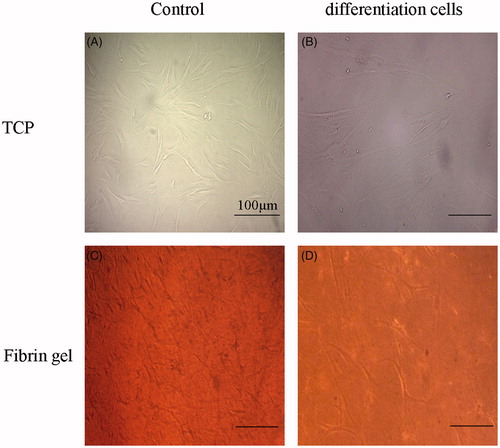 Figure 5. Phase-contrast images of CJMSCs cultured for 7 days in control group (A), and in fibrin gel (C). Phase-contrast images of CJMSCs-derived photoreceptor-like cells cultured for 14 days in control group (B), and in fibrin gel (D). Magnification * = 40, scale bar * 100 μm).