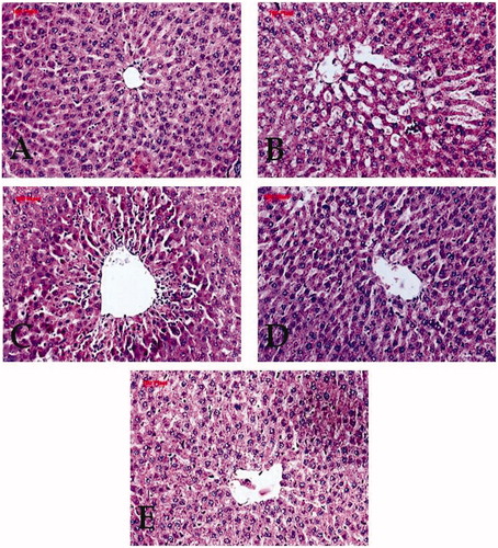 Figure 8. Effect of SXAF on the histological morphology of rat liver by hematoxylin and eosin (H & E) staining, magnification, ×400. (A) Normal control, (B) CCl4 control, (C) SXAF 100 mg/kg b.w. + CCl4, (D) SXAF 200 mg/kg b.w. + CCl4, and (E) silymarin 25 mg/kg b.w. + CCl4.