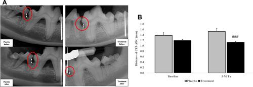 Figure 5 The distance (mm) from cementoenamel junction (CEJ) to alveolar bone crest (ABC) was measured by radiography for CMC2.24 and placebo groups at baseline and 3 months. (A) Arrows in circles indicate the distance of alveolar bone loss. (B) Grey bar: Placebo group; black bar: CMC2.24 treatment group. Each value represents the mean (79–104 sites/per group) ± S.E.M. ###Indicates p<0.001, values compared to placebo at 3-month time period.