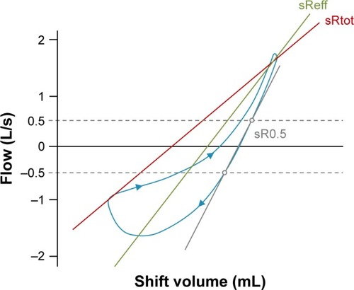 Figure 3 A typical sRaw loop in a patient with airflow obstruction, where shift volume is plotted against airflow.