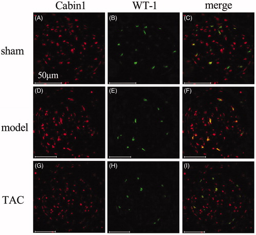 Figure 3. TAC stabilized the distribution of Cabin1 in 5/6 nephrectomized rats (original magnification: ×400). (A–C) In sham-operated rats, Cabin1 was mainly localized in glomerular innate cells and partly overlap with WT-1 in the nuclei of podocytes. (D and E) In 5/6 nephrectomized rats, the overlap of Cabin1 and WT-1 in podocyte nuclei was much more obvious than sham-operated rats. (G–I) In TAC treated rats, the distribution of Cabin1 in podocyte nuclei maintained to the original pattern of sham-operated rats.