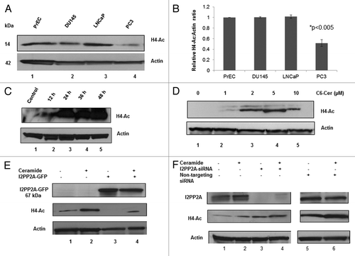 Figure 7. The role of I2PP2A in histone acetylation in PC3 cells. (A) Detection and quantification of histone 4 acetylation in PC and PrEC cells. Cells were grown to 80% confluency and then western blot analysis was performed to determine the level of acetylated histone 4. (B) Densitometry analysis of the protein bands of H4-Ac and actin were determined using ImageJ software, and the results for H4-Ac normalized to the loading control actin; P < 0.05 was considered as significant (calculated using two tailed, paired t test). (C) C6-ceramide inhibits I2PP2A function and increases H4-Ac with time. Cells were treated for 0 to 48 h with 10 µM C6-ceramide, and then H4-AC levels were determined. (D) Increasing the concentration of C6-ceramide increases H4-Ac through inhibition of I2PP2A. Cells were treated with the indicated concentration of C6-ceramide, and H4-Ac levels were evaluated. (E) Overexpression of I2PP2A in PC3 cells enhances the decrease in H4-Ac levels. (F) Knockdown of I2PP2A in PC3 cells increases H4-Ac levels, and 10 μM ceramide treatment for 48 h increases H4-Ac levels.
