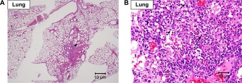 Figure 6 Histopathological analysis of lung.Note: Histopathological analysis with H&E staining of lung showing moderate focal inflammation (arrow) at (A) 20× and (B) 400× magnifications.
