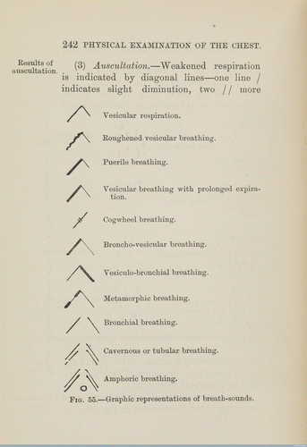 Figure 2. Graphic representations of breath sounds are sometimes printed in medical textbooks, especially in late nineteenth/early twentieth-century editions. Source: Crocket, Physical Examination of the Chest, 242, Fig. 55. Wellcome Library, London, Ref. L0073570.