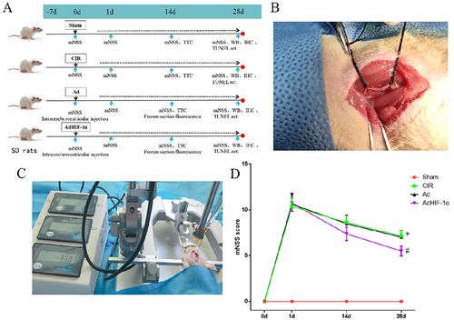 Figure 1 Rat grouping, modeling and treatment; mNSS scores in each group. (A) Schematic diagram of rat grouping and treatment; (B) tMCAO rat model; (C) Lateral ventricular injection; (D) mNSS scores in rats of each group at different time points (n = 8, *P < 0.05 vs Sham group; #P < 0.05 vs CIR group or Ad group).