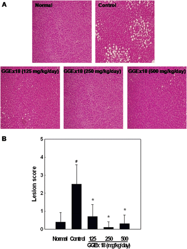 Figure 1.  Effects of Gyeongshingangjeehwan 18 (GGEx18) on hepatic lipid accumulation in high-fat diet-induced obese mice. Adult male C57BL/6 mice (n = 8/group) were fed a low-fat diet (Normal), a high-fat diet (Control), or the high-fat diet supplemented with 125, 250, or 500 mg/kg/day GGEx18 for 9 weeks. (A) Representative hematoxylin and eosin-stained sections of livers are shown (original magnification, ×100). (B) Histological analyses of hepatic lipid accumulation. Pathological scores of hepatic lipid accumulation are as follows: 0, no lesion; 1, mild; 2, moderate; 3, severe; 4, very severe. All values are expressed as the mean ± standard deviation of four independent experiments. #p < 0.05 compared with the normal group, *p < 0.05 compared with the control group.
