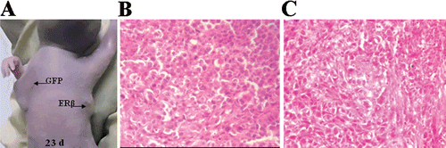 Figure 7.  Representative image and pathological examination of xenografts of polyclonal MCF-7 cells stably transfected with GFP or ERβ. 2 × 106 ERβ-transfected and GFP-transfected polyclonal MCF-7 cells suspended in 200 μl normal medium were transplanted subcutaneously into the right and left armpit, respectively, of six female BALB/c-nu nude mice without Matrigel. (A) Representative image of xenografts at day 23. (B) Representative image of pathological examination of MCF-7-GFP xenografts by H&E stain (original magnification ×100). (C) Representative image of pathological examination of MCF-7-ERβ xenografts by H&E stain (original magnification ×100).