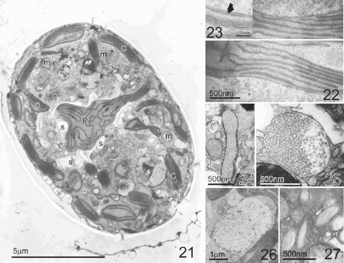 Figs 21–27. TEM of Pileidinium ciceropse, gen. et sp. nov. Fig. 21. Longitudinal section through the cell. Pyrenoid is surrounded by starch grains. Fig. 22. Detail of chloroplast. Fig. 23. High magnification of chloroplast. Arrowheads indicate the triple membranes of the chloroplast boundary. Fig. 24. Sausage-shaped vesicles. Fig. 25. Polyvesicular body. Fig. 26. Vesicles in which filaments radiate in all directions. Fig. 27. Hair containing vesicles. Abbreviations: Py; pyrenoid, G; Golgi body, C; chloroplast, m; mitochondria, s; starch grain.