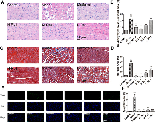 Figure 4 Ginsenoside Rb1 reduced myocardial inflammation, hypertrophy, fibrosis, and apoptosis in diabetic mice. (A) Representative images of hematoxylin–eosin (HE) staining and (B) cross-sectional areas in indicated groups. (C) Representative images of Masson staining and (D) statistical analyses of fibrotic ratios in different groups. (E) Representative TUNEL staining images and (F) statistical analyses of cardiomyocyte apoptotic index in six groups. Scale bar, 50 μm. Data are expressed as the mean ± SEM (n = 3–6). ***p<0.001 or *p<0.05 vs model group; ###p<0.001 vs the control.