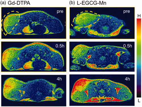 Figure 9. In vivo T1WI MR images (3 T) of H22 tumor-bearing mice pre- and post-intravenous injection (i.v.) with Gd-DTPA (a) or L-EGCG-Mn NPs (b). The images are displayed at a window width of 2588 and window level of 1324. L-EGCG-Mn NPs led to a higher enhancement of tumor contrast than Gd-DTPA.