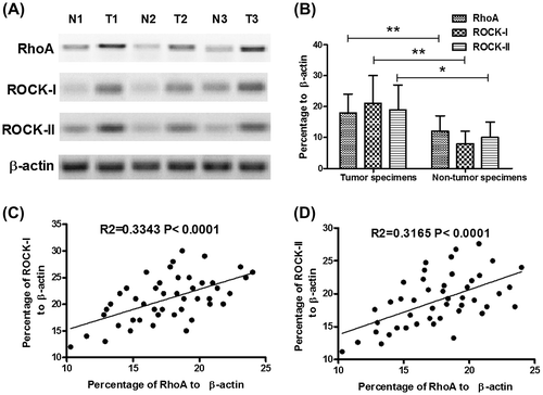 Fig. 1. Overexpression of RhoA and ROCK-I/II in CC specimens.Notes: (A) and (B) overexpression of RhoA and ROCK-I/II in part CC specimens; and (C) and (D) correlation of RhoA overexpression with the ROCK-I(C) or ROCK-II (D) expression. Statistical significance was considered with a p value < 0.05 or less.