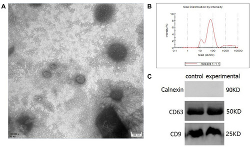 Figure 2 Characterization of exosome isolated from serum. (A) TEM image of isolated exosome from human serum. (B) DLS image of isolated exosome from human serum. (C) Detection of antibody CD9, CD63 and calnexin by Western blotting in pooled control (n = 17) and experimental (n = 15) samples.