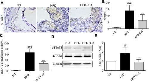 Figure 4 STAT3 phosphorylation in aortas of HFD-fed ApoE−/− mice was increased.