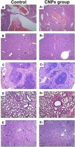 Figure 11 H&E staining of heart (A and A1), kidney (B and B1), spleen (C and C1), lung (D and D1) and liver (E and E1) from mice receiving CNPs group and control.