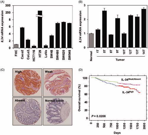 Figure 1. IL-34 is expressed in colorectal cancer cells lines and primary cancer tissues. (A) qRT-PCR analysis of IL34 expression in colorectal cancer cell lines compared to fetal human colon epithelial cells (FHC). Expression value of each samples were normalized by FHC. Representative data (mean ± SE) of qRT-PCR is shown. Similar results were obtained in two independent experiments. (B) qRT-PCR analysis of IL34 expression in primary colorectal cancer tissues collected from 8 patients (T1, T5, T8, T9, 10, T12, T13 and T14) compared to normal colon epithelium from healthy donor (‘Normal’). Expression value of each samples were normalized by the ‘Normal’ tissue. Representative data (mean ± SE) of qRT-PCR is shown. Similar results were obtained in two independent experiments. (C) Immunohistochemistry staining of IL-34 in primary colorectal cancer tissues compared to the normal human colon epithelium. Representative samples at each expression intensity (high, weak and absent) are shown. (D) A Kaplan–Meier analysis showing overall survival in our cohort of colorectal cancer patients (n = 292) based on IL-34 expression (IL-34High (n = 114), IL-34Weak/Absent (n = 178)).