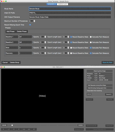 Figure 2. The PAiN software study template window and coding window, following the usability evaluation.