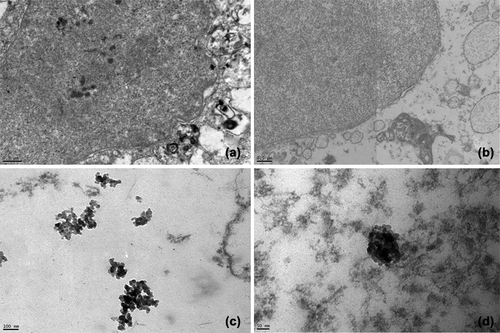 Figure 6. TEM images of L929 cells incubated for 24 h with AO-loaded PHEMA nanoparticles showing coagulation of nanoparticles in cell compartments at an accelerating voltage of 120 kV (a, c, d). L929 cells just as control is seen in b).
