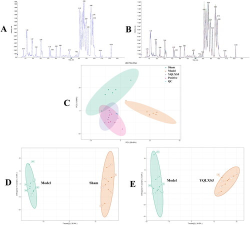 Figure 4. Metabolomics profile for YQLXSJ intervention in rats. (A) TIC of QC samples. (B) TIC of all samples. (C) PCA of the sham, model, YQLXSJ, positive and QC groups. (D) OPLS-DA of the sham and model groups. (E) OPLS-DA of the model and YQLSXJ groups.