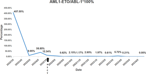 Figure 1 Minimal residual disease of AML1/ETO expression by quantitative RT-PCR assays. The expression level of fusion gene decreased from 407.55% at diagnosis to 0.00% (MRD negative) 19 months after allo-HSCT (cured).
