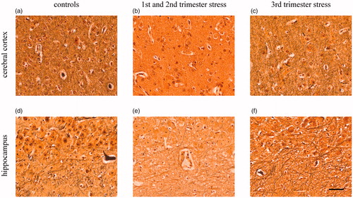 Figure 2. Effects of chronic maternal stress on neuronal network formation in frontal cortex and hippocampus of the fetal sheep brain at 0.87 gestation. Representative photomicrographs of silver staining of the cerebral cortex (a–c) and the CA3 region of the hippocampus (d–f). Stress during the first and second trimester but not stress during the third trimester reduced the area of silver staining. Scale bar 50 µm.