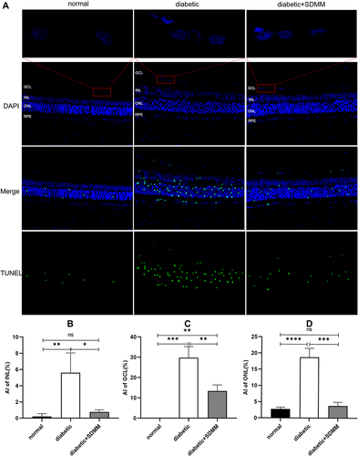 Figure 2 Effects of Shuangdan Mingmu (SDMM) capsules on STZ-induced retinal apoptosis in diabetic rats. (A) Images of retinal TUNEL staining; (B-D) AI of INL, GCL and ONL, respectively, in each group. Positive signal is green fluorescence, blue is nuclear staining signal, AI = number of apoptotic cells/number of total cells×100%. χ±s, n=3, *p<0.05, **p<0.01, ***p=0.0001, ****p<0.0001, scale bar 100um.