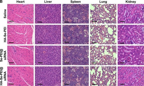 Figure 9 (A) H&E, Ki67, and CD31 immunohistochemistry analysis of the tumors treated with saline, HA-Se-PEI, Se-PEI@siRNA, and HA-Se-PEI@siRNA. Yellow arrows were employed to highlight the immunohistochemical characteristics. Scale bar is 50 μm. (B) H&E analyses of heart, liver, spleen, lung, and kidney after treatment with saline, HA-Se-PEI, Se-PEI@siRNA, and HA-Se-PEI@siRNA, respectively. Scale bar is 50 μm.Abbreviations: HA, hyaluronic acid; H&E, hematoxylin and eosin; PEI, polyethylenimine; Se, selenium; siRNA, small interfering RNA.