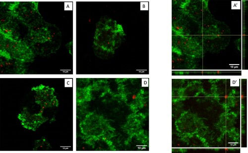 Figure 5. Confocal microscopy of A. polyphaga infected by F. tularensis Ft6. (A) T0 in PYG/wg; (B) D2 in PYG/wg; (C) D7 in PYG/wg; (D) T0 in SM; No more bacteria were observed inside amoeba at D7 in SM (data not shown). A’) orthogonal view of T0 in PYG/wg; D’) orthogonal view of T0 in SM. Green: actin (phalloidin Alexa Fluor 488). Red: Francisella sp. (rabbit primary antibody against Francisella, goat secondary antibody against rabbit Alexa Fluor 594).