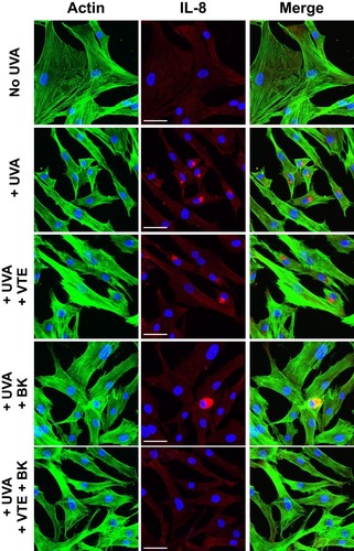 Figure 1 Combination of BK+VTE improves UVA-induced morphology alteration and inflammation in human dermal fibroblasts. Fibroblasts were treated in the presence or absence of VTE or BK alone or in combination. Cells were then irradiated using UVA and analysed by laser scanning confocal microscopy. Pictures show immunofluorescence staining of actin network (green labelling) and interleukin-8 (red labelling) as markers of morphology and inflammation, respectively. Cultures were counter-stained with DAPI to locate the nuclei of fibroblasts (blue labelling). Scale bar = 50 µm.