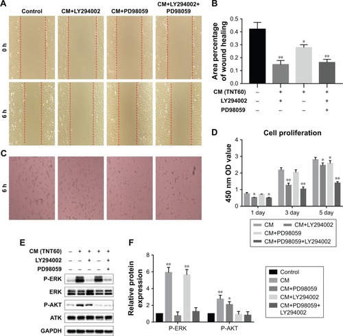 Figure 6 Effects of AKT and ERK1/2 pathway inhibitors on endothelialization.Notes: (A) Representative images of HUVEC migration. (B) The percentage of coverage after 6 hours of wound healing. (C) Representative images of tube formation for 6 hours. (D) Cell proliferation in HUVECs for 1, 3, and 5 days. (E) Determination of AKT and ERK1/2 phosphorylation in HUVECs by Western blot. (F) Analysis of AKT and ERK1/2 phosphorylation using the images shown in E. Results are presented as mean ± SD (N=3). *P<0.05, **P<0.01.Abbreviations: LY294002, AKT pathway inhibitor; PD98059, ERK1/2 pathway inhibitor; HUVEC, human umbilical vein endothelial cell; CP, TNT20, TNT40, and TNT60, conditioned medium from commercially pure Ti or TiO2 nanotubes produced by 20, 40, or 60 V; CM, conditioned medium.