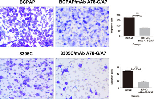 Figure 5 In vitro migration assay of BCPAP and 8305C cells.Notes: TC cells, treated with or without mAb A78-G/A7, were examined in a transwell plate. Each cell line was divided into two groups that were treated with or without mAb A78-G/A7. BCPAP and 8305C cells on the membranes were stained with crystal violet (×100). Bar graphs below the stained migration membranes show the results of the migration assay, as analyzed using ImageJ software. Results are expressed as the pixel intensity of the scanned stained migration membranes relative to negative controls. The horizontal coordinate represents the groupings, respectively are: BCPAP (papillary thyroid cancer cells) and BCPAP/mAb A78-G/A7 (BCPAP cells with mAb A78-G/A7 treated); 8305C (anaplastic thyroid cancer cells) and 8305C/mAb A78-G/A7 (8305C cells with mAb A78-G/A7 treated). The ordinate represents the migration cells. Data=means±SEM. Relative to the blank control group, ***P<0.001.Abbreviations: mAb A78-G/A7, Thomsen–Friedenreich monoclonal antibody (A78-G/A7); TC cell lines, thyroid cancer cell lines.