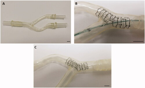 Figure 2. ‘Ex vivo’ silicon tube bifurcation model (A). (B) shows a zinc-stent after implantation into one tube with the stent center facing the orifice of the other tube. (C) indicates the result after balloon dilatation though the mesh of the ultra-thin center struts to further open the sidebranch orifice and prevent side branch stent jail in the model. The marker represents 5 mm.