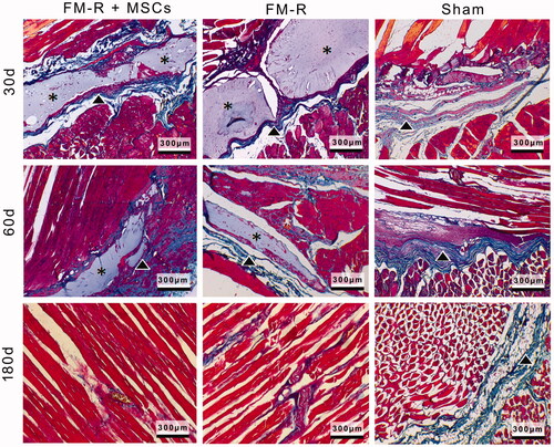Figure 7. Representative Masson’s trichrome-stained sections of the muscle explants retrieved from subjects with VML injury at 30, 60 and 180 days post-transplantation. Collagen deposition (indicated with arrow heads) was evident between muscle fibres and microbeads (asterisks) in the FM-R and FM-R + MSCs groups at 30 and 60 days, whereas collagen deposition had decreased and muscle regeneration was noted after 180 days in these groups. However, in the Sham group, collagen deposition was strongly evident after 60 days, which later demonstrated an incomplete repair process with fibrotic scar tissue at 180 days. Scale bars: 300 µm.