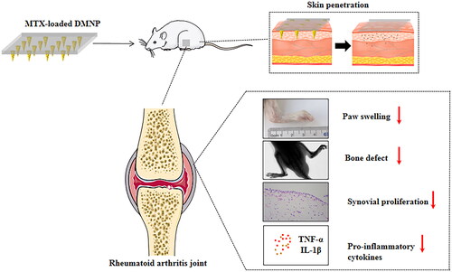 Figure 1. Graphical abstract of the present study. AIA rats were treated with the MTX-loaded DMNP to inhibit RA progression.