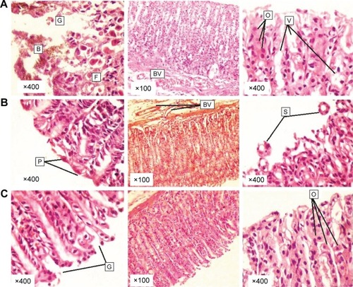 Figure 8 Histopathological images of the stomach of rats.Notes: After treatment with (A) PX crystalline powder, showing severe disruption of gastric pits (G) with bleeding spots (B) and infiltrated inflammatory cells (F), congestion of submucosal blood vessels (BV), many vaculated glandular cells (V), and numerous oxyntic cells (O) (H&E stain). (B) P188/0.2 formulation, showing creeping of the surface epithelial cells with blunting of many gastric pits (P), normal uncongested submucosal blood vessels (BV), and separated gastric glands (S) of mild ulceartion (H&E stain), and (C) Tween 80 (H&E staining, ×400), showing narrow gastric pits (G). The lamina propria is fully occupied by fundic/gastric glands lined by mucous neck cells and oxyntic cells (O) (H&E stain).Abbreviations: PX, piroxicam; H&E, hematoxylin and eosin; P188, poloxamer 188.