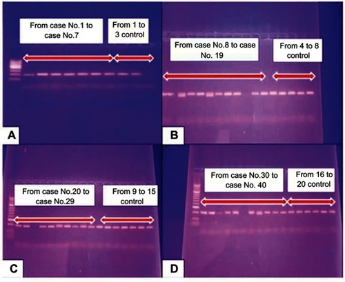 Figure 3 Conventional PCR results of IGF-1 (CA19) gene polymorphism from case No. 1 to case No. 7 and from No. 1 to No. 3 control (A), from case No. 8 to case No. 19 and from No. 4 to No. 8 control (B), from case No. 20 to case No. 29 and from No. 9 to No. 15 control (C) and from case No. 30 to case No. 40 and from No. 16 to No. 20 control (D).