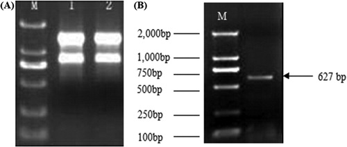 Figure 2. Agarose electrophoresis of total extracted RNA (a) and amplified MAPK conserved sequence (b) from Tiger lily (L. lancifolium). Note: M：DL 2, 000TM DNA molecular size marker.