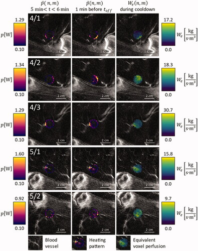 Figure 4. Overlay on contrast enhanced MRI images of the respective anatomical region, for animals 4 and 5: Average power application pattern during the first minute after warmup (leftmost column), during the last minute before HIFU shutdown (middle column) and equivalent voxel perfusion during the first minute of cooldown (rightmost column).
